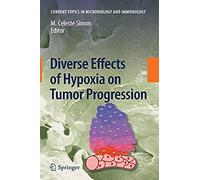 Diverse Effects Of Hypoxia On Tumor Progression