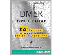 DMEK Tips & Tricks: 50 tactics to make DMEK easier and more fun