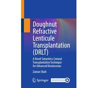 Doughnut Refractive Lenticule Transplantation (DRLT): A Novel Sutureless Corneal Transplantation Technique for Advanced Keratoconus
