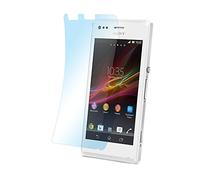 doupi Protecteur Écran pour Sony Xperia M (4 Pouces), Ultrathin Mat Anti Reflex Antireflet Protection Afficher Pellicule (3X en Pack)