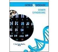 Down Syndrome, Genes and Disease F. Fay Evans-Martin (Auteur)