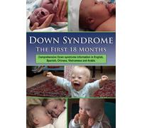 Down Syndrome: The First 18 Months