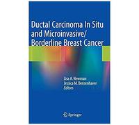 Ductal Carcinoma In Situ And Microinvasive/Borderline Breast Cancer