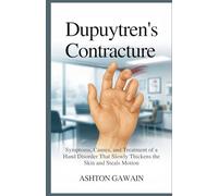 Dupuytren’s Contracture: Symptoms, Causes, and Treatment of a Hand Disorder That Slowly Thickens the Skin and Steals Motion