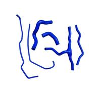 durites de radiateur de voiture Compatible Avec Chevy Pour Cruze 1.6 1.8 Pour Turbo 2011 2012 2013 2014 Tuyau De Débordement Radiateur De Liquide De Refroidissement(Blue)