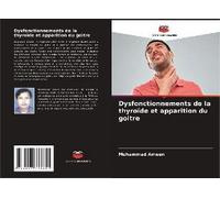 Dysfonctionnements De La Thyroïde Et Apparition Du Goitre