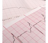 EasyTrace ® 20 pièces PAQUETS DE PAPIER THERMIQUE POUR ECG SCHILLER AT-110, AT10 PLUS [SH210140P3] Dimension paquet: mm 210 x mm 140 x 160 Feuilles