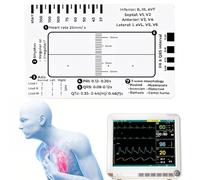 ECG 7 Step Ruler, Règle ECG à 7 Étapes, ECG/EKG 7 Step Ruler Card for ECG/EKG Interpretation, Follow a 7 Step Plan, Transparent EKG Calipers Measuring Tool, Portable ECG Assessment Tool EKG Card (1)