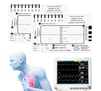 ECG 7 Step Ruler, Règle ECG à 7 Étapes, ECG/EKG 7 Step Ruler Card for ECG/EKG Interpretation, Follow a 7 Step Plan, Transparent EKG Calipers Measuring Tool, Portable ECG Assessment Tool EKG Card (2)