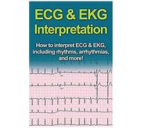 Ecg & Ekg Interpretation