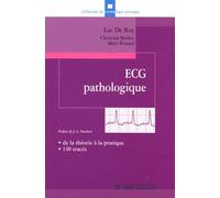 ECG pathologique: de la théorie à la pratique, 140 tracés