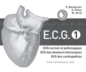 ECG tome 1: ECG normal et pathologique, ECG des douleurs thoraciques, ECG des cardiopathies