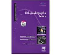 Echocardiographie foetale - Françoise Boussion - Elsevier Masson - broché - Scolaire / Universitaire
