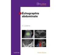 Echographie Abdominale