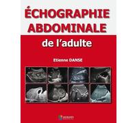 Echographie abdominale de l'adulte