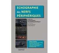ECHOGRAPHIE DES NERFS PERIPHERQUES