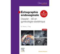 Échographie endovaginale Doppler - 3D: en gynécologie-obstétrique