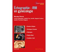Echographie - IRM en gynécologie: Echographie- Irm