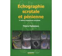 ECHOGRAPHIE SCROTALE ET PENIENNE