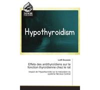Effets des antithyroïdiens sur la fonction thyroïdienne chez le rat Impact de l'Hypothyroïdie sur la maturation du systeme Nerveux Central - Lotfi Soussia - Noor Publishing - broché - Etude