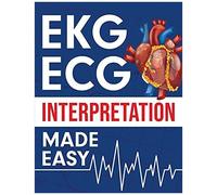 Ekg Ecg Interpretation Made Easy