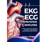 EKG | ECG Interpretation Simplified: A Step-by-Step Guide to Building Confidence in Identifying and Understanding Cardiac Rhythms