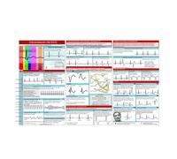 EKG Pocket Guide, Carte De Poche D'interprétation EKG, Carte D'électrocardiogramme Double Face À Trois Volets, Guide De Référence Compact Et Portable, Outil D'analyse Du Rythme Cardiaque