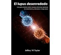 El lupus desenredado: Una guía práctica sobre causas, síntomas, opciones de tratamiento y bienestar a largo plazo
