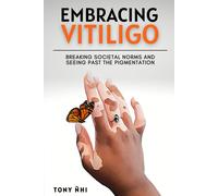 Embracing Vitiligo: Breaking Societal Norms And Seeing Past The Pigmentation: Finding Self-Confidence With Vitiligo & 100 Affirmations For Embracing The Skin You're In
