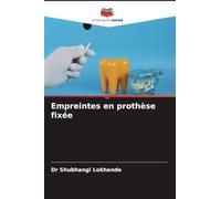 Empreintes en prothèse fixée