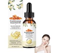 Encens Oliban Bio Huile Essentielle Pure,Huile d'encens premium, pure et naturelle, bio, pour la peau, antirides, huiles essentielles pour le corps, soins capillaires, diffuseurs, massage (1)