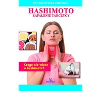 Encyclopédie de la santé Thyroïdite de Hashimoto