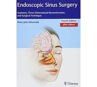 Endoscopic Sinus Surgery