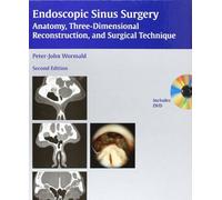 Endoscopic Sinus Surgery: Anatomy, Three-dimensional Reconstruction, and Surgical Technique