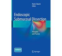 Endoscopic Submucosal Dissection: Principles and Practice
