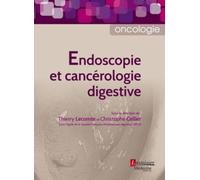 Endoscopie Et Cancérologie Digestive