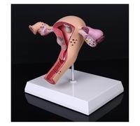 Ensemble Accessoires Médicaux Modèle Humain Femelle Pathologique Utérus Ovaire Moèle Anatomique Maladie Pathologie Lésion Médicale for Enseignement De La Biologie