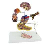 Ensemble de modèles de diabète - Modèle de pathologie diabétique humaine avec 8 composants pour la communication médecin-patient, comprend un affichage du pied, du cerveau, du cœur, des reins et de la
