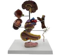 Ensemble de modèles pathologiques du diabète humain, 8 pièces | Modèle de diabète de type II pour la communication médecin-patient et l'apprentissage de la physiologie