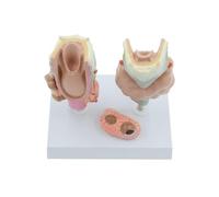 Ensemble de modèles thyroïdiens, modèle de pathologie thyroïdienne