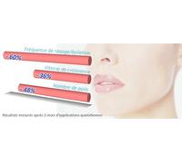 Epil Xpress Lotion Réducteur De Pilosité Pour Le Visage