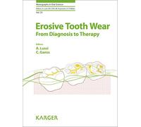 Erosive Tooth Wear: From Diagnosis to Therapy