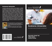 Escáneres intraorales: Una nueva era para la impresión convencional