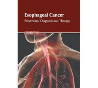 Esophageal Cancer: Prevention, Diagnosis and Therapy