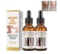 Essence de blanchiment de la main, sérum éclaircissant la peau, réduit l'âge d'hyperpigmentation, élimine les doigts des chevilles foncées, pour les articulations, les coudes, 30 ml x 2 g