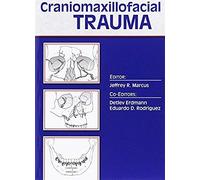 Essentials Of Craniomaxillofacial Trauma