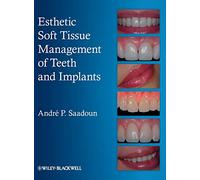 Esthetic Soft Tissue Management of Teeth and Implants