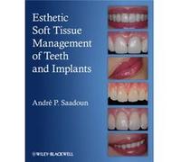 Esthetic Soft Tissue Management of Teeth and Implants by Saadoun & Andre P. Private practitioner and internationally renowned lecturer in Esthetic Periodo Saadoun Andre P. Private practitioner and int