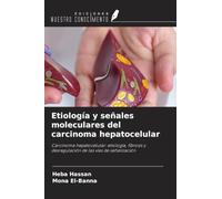 Etiología y señales moleculares del carcinoma hepatocelular: Carcinoma hepatocelular: etiología, fibrosis y desregulación de las vías de señalización