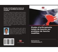 Etudes D'arthroplastie Totale De Hanche Sur Prothèse De Hanche Modifiée